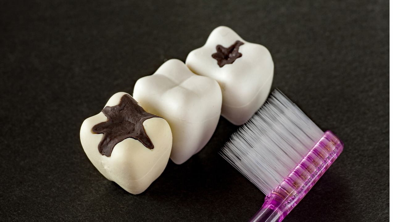 岩沼市の虫歯の早期発見・早期治療