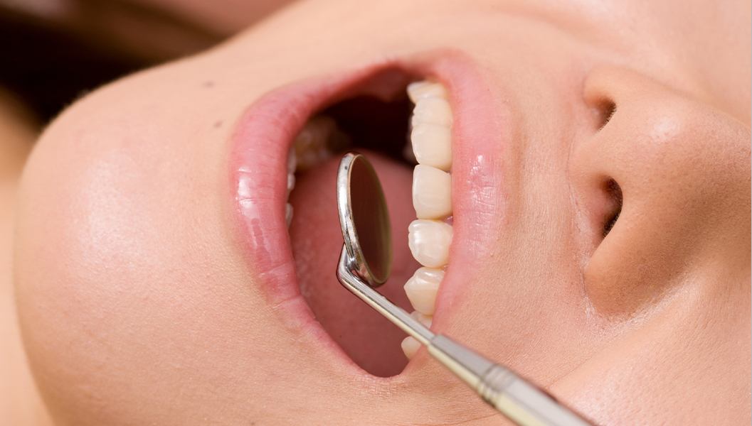 岩沼市のなるべく痛くない虫歯治療