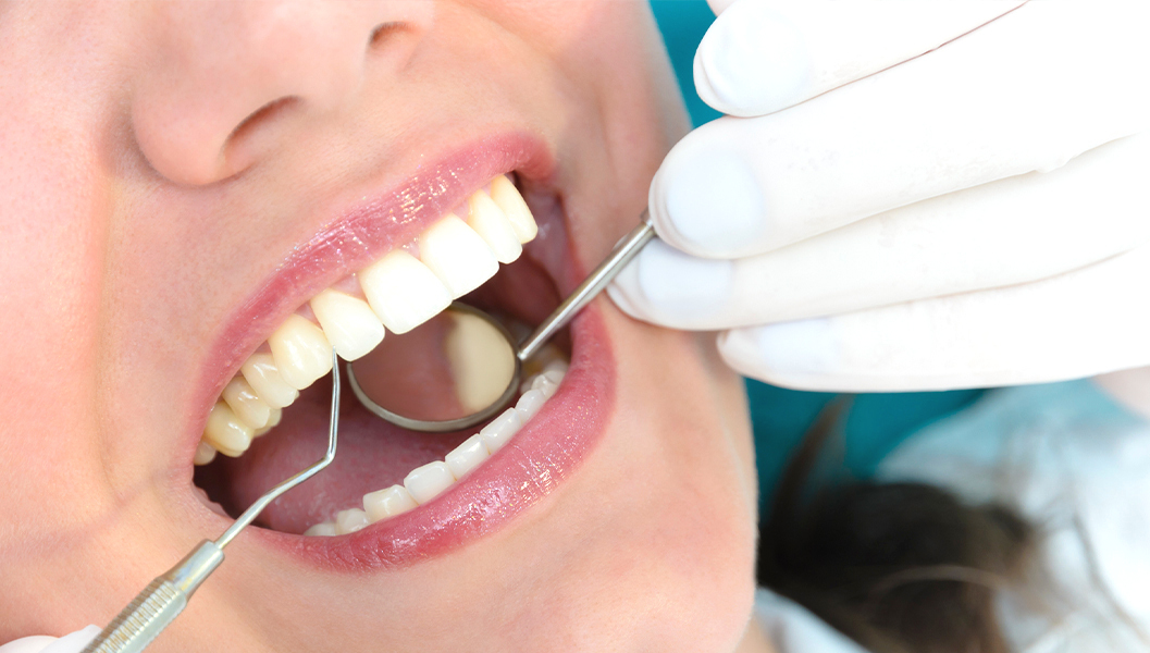 岩沼市のなるべく痛くない虫歯治療