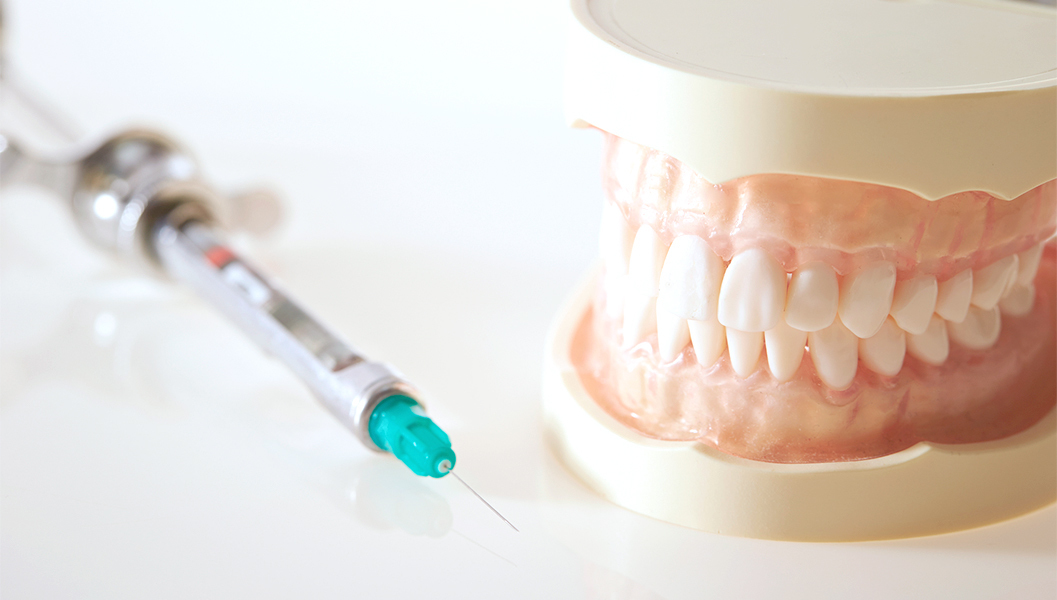 岩沼市のなるべく痛くない虫歯治療